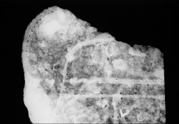 갑옷 X-ray 사진