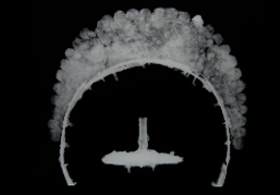투구2 X-ray 사진