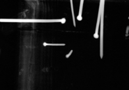 X-ray 세부사진