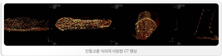 안동고분 식리의 다양한 CT 영상